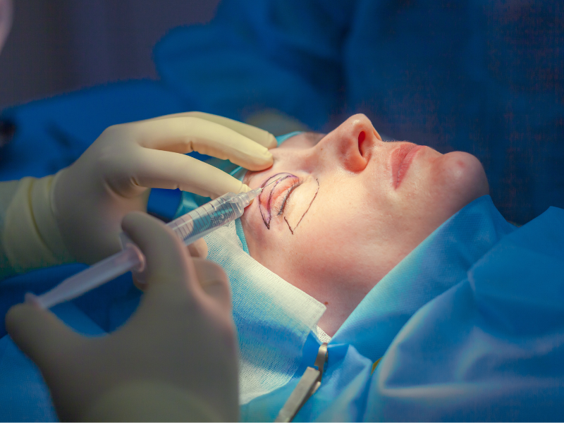 Understanding the Difference Between Upper and Lower Blepharoplasty